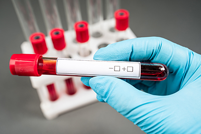 Blood sample test and empty tube