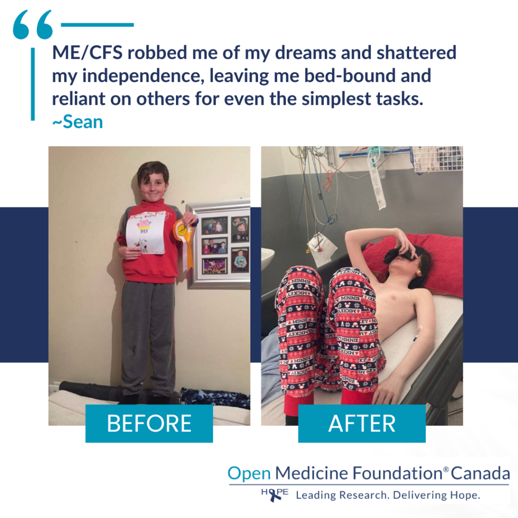 A before-and-after snapshot of Sean's life. On the left, Sean beams proudly with a writing competition medal. On the right, he lies in a hospital bed, wearing a sleep mask. Sean's quote: "ME/CFS robbed me of my dreams, shattered my independence, leaving me bed-bound and reliant on others."